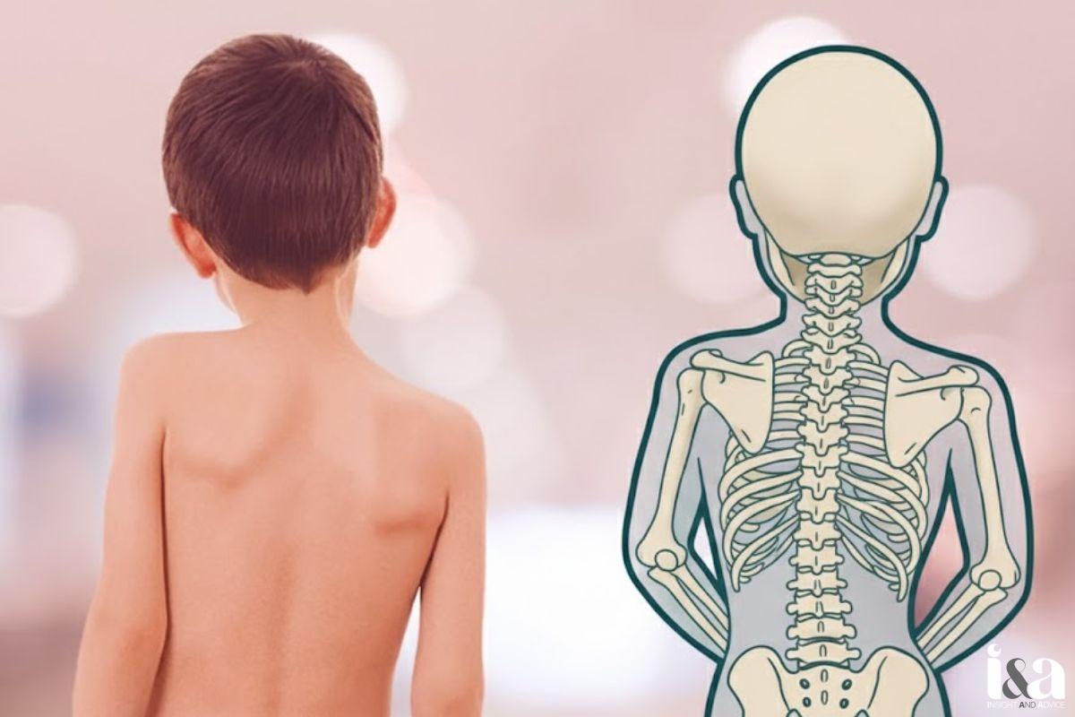 phòng khám chữa cong vẹo cột sống cho trẻ em